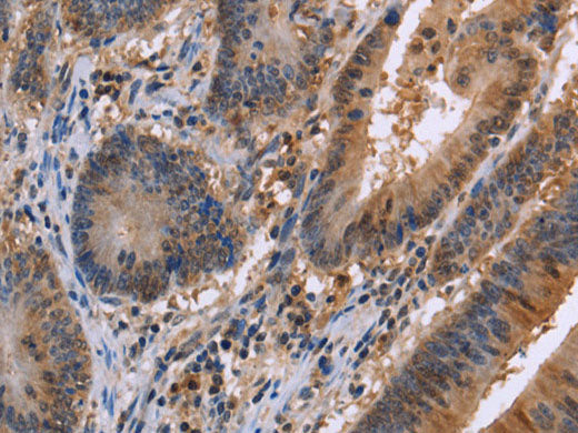FAAH2 Polyclonal Antibody Store at -20°C