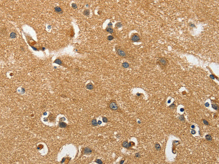 EPHB3 Polyclonal Antibody Store at -20°C