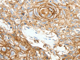 SCN10A Polyclonal Antibody