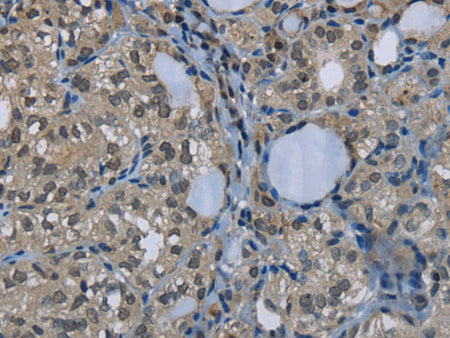GYS1 Polyclonal Antibody Store at -20°C