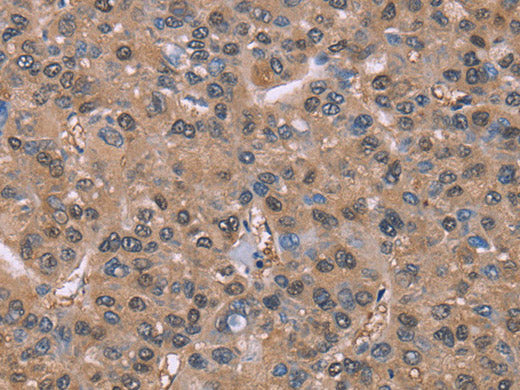 GLYR1 Polyclonal Antibody Store at -20°C