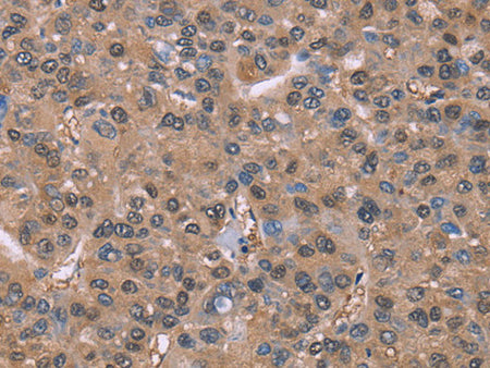 GLYR1 Polyclonal Antibody Store at -20°C