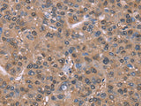 GLYR1 Polyclonal Antibody Store at -20°C