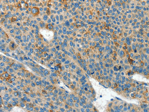 CLPTM1L Polyclonal Antibody Store at -20°C