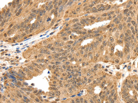 SPATA20 Polyclonal Antibody Store at -20°C