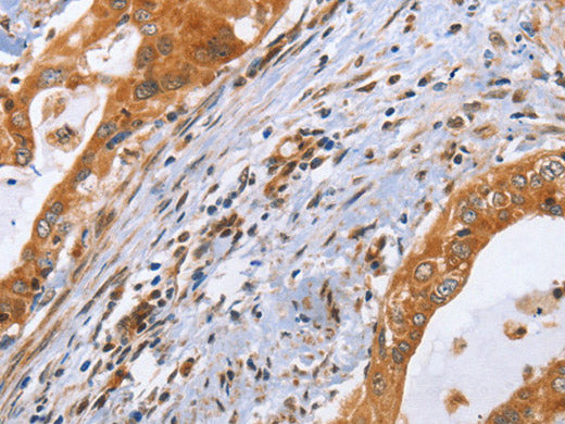 CDK19 Polyclonal Antibody Store at -20°C