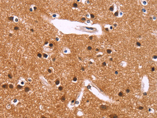 IRAK1BP1 Polyclonal Antibody Store at -20°C