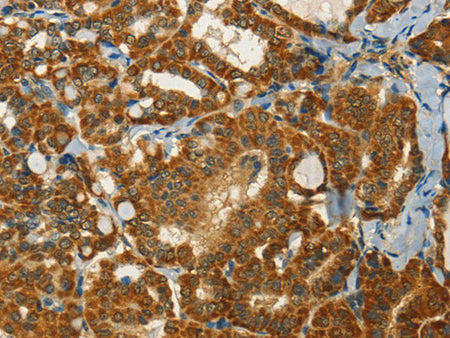 NPAP1 Polyclonal Antibody Store at -20°C
