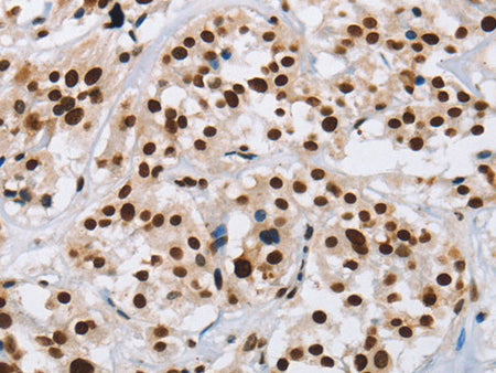IL17C Polyclonal Antibody Store at -20°C