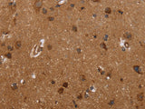 FMN2 Polyclonal Antibody