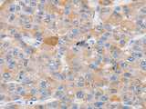 SLC25A13 Polyclonal Antibody Store at -20°C