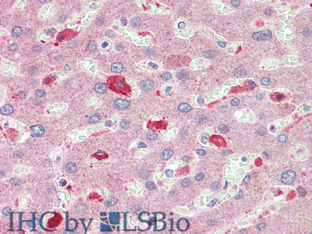 BCAT1 Polyclonal Antibody Store at -20°C