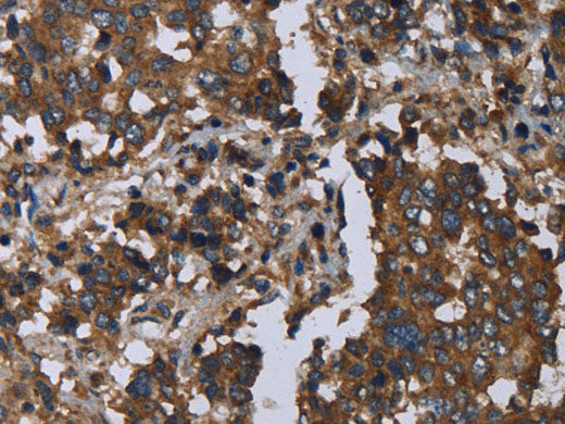 GOLGA2 Polyclonal Antibody Store at -20°C