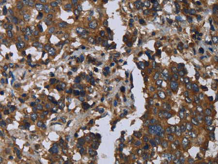 GOLGA2 Polyclonal Antibody Store at -20°C