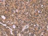 ERAS Polyclonal Antibody