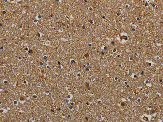 KLK6 Polyclonal Antibody Store at -20°C