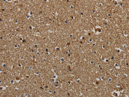 KLK6 Polyclonal Antibody Store at -20°C