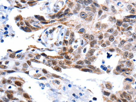 GSK3 alpha Polyclonal Antibody Store at -20°C