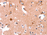 ABI1 Polyclonal Antibody Store at -20°C