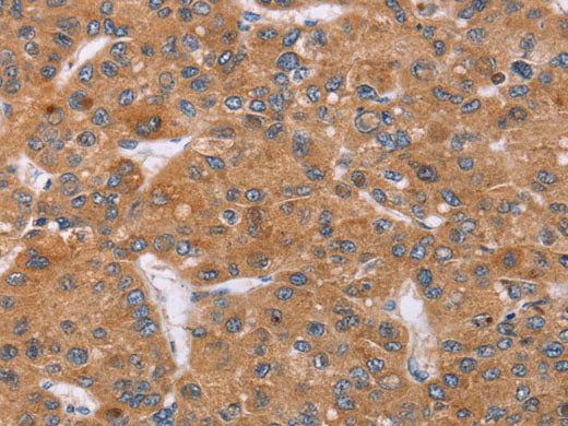 PPP2R3C Polyclonal Antibody Store at -20°C