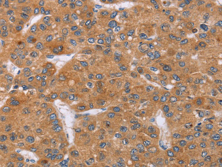 PPP2R3C Polyclonal Antibody Store at -20°C