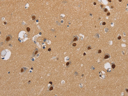 KCNG4 Polyclonal Antibody Store at -20°C