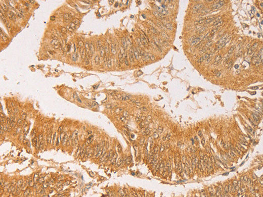 AK2 Polyclonal Antibody Store at -20°C