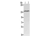 RGS22 Polyclonal Antibody