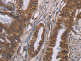 GRK1 Polyclonal Antibody Store at -20°C