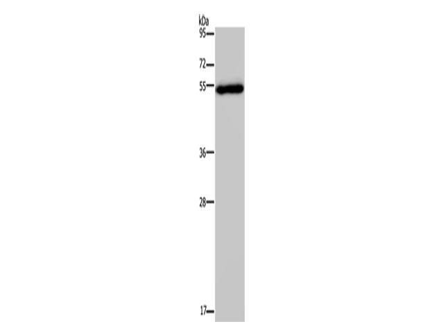 FOXC2 Polyclonal Antibody Store at -20°C