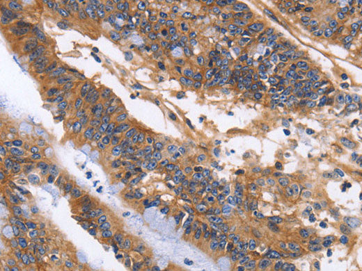 ITGB1 Polyclonal Antibody Store at -20°C