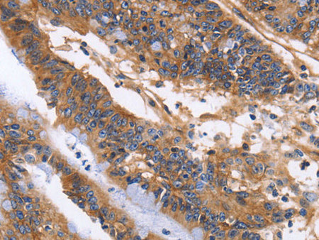 ITGB1 Polyclonal Antibody Store at -20°C