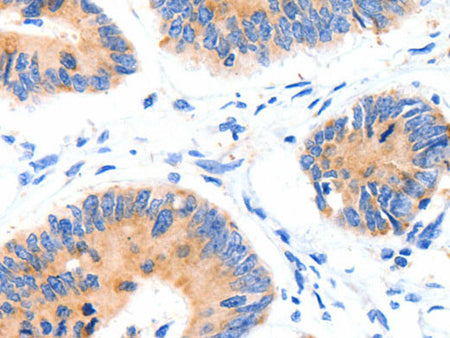 GLUT-4 Polyclonal Antibody Store at -20°C