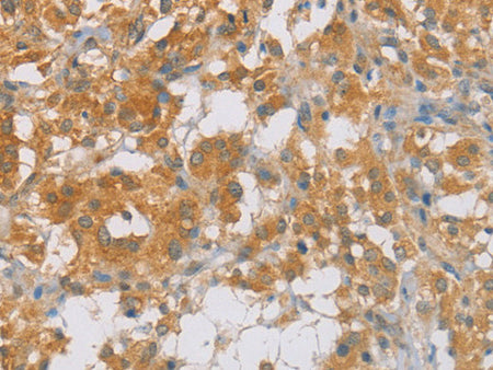 p16 Polyclonal Antibody Store at -20°C