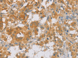 p16 Polyclonal Antibody Store at -20°C