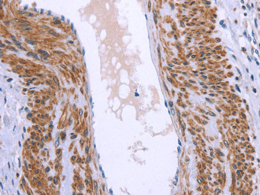 GNPAT Polyclonal Antibody Store at -20°C
