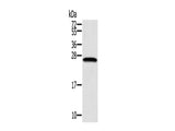 SSX1 Polyclonal Antibody