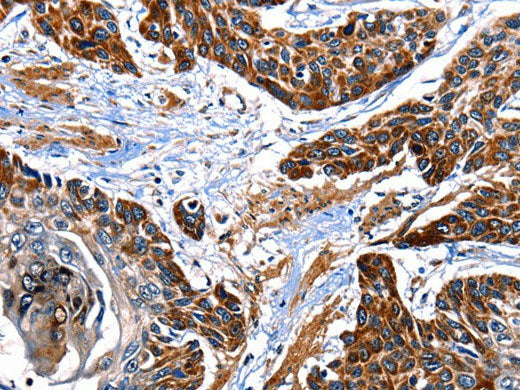 ITGA7 Polyclonal Antibody Store at -20°C