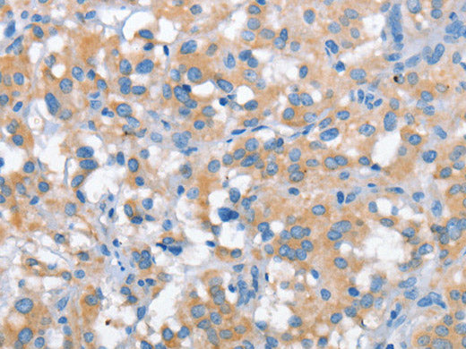 SNCA Polyclonal Antibody Store at -20°C