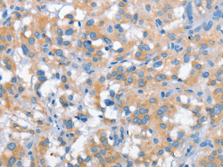 SNCA Polyclonal Antibody Store at -20°C