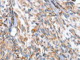 APOBEC3D Polyclonal Antibody