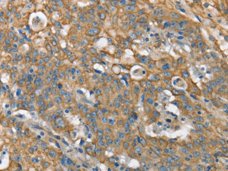 CSMD1 Polyclonal Antibody Store at -20°C