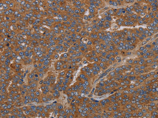 GDF2 Polyclonal Antibody Store at -20°C