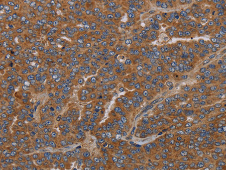 GDF2 Polyclonal Antibody Store at -20°C