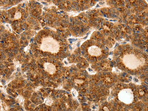 TEK Polyclonal Antibody Store at -20°C