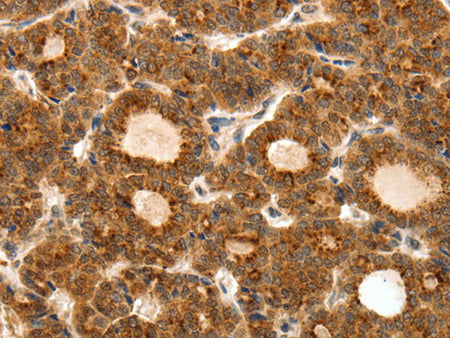 TEK Polyclonal Antibody Store at -20°C