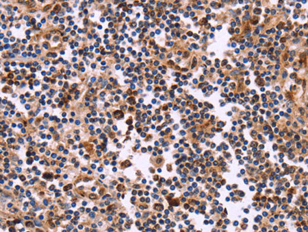 CLUAP1 Polyclonal Antibody Store at -20°C
