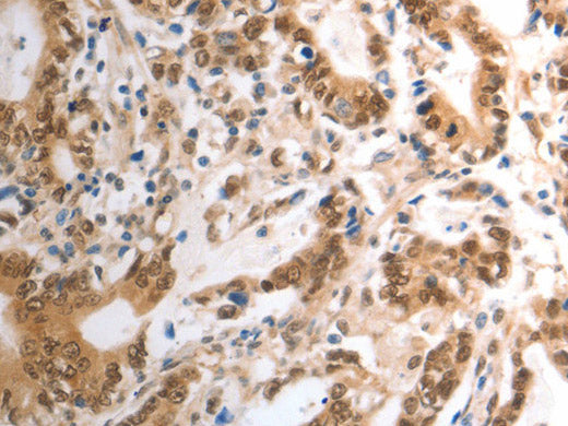 RAD50 Polyclonal Antibody Store at -20°C