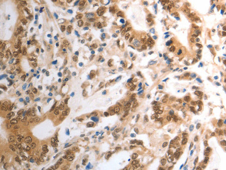 RAD50 Polyclonal Antibody Store at -20°C