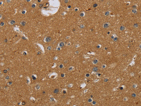 Glucocorticoid Receptor Polyclonal Antibody Store at -20°C